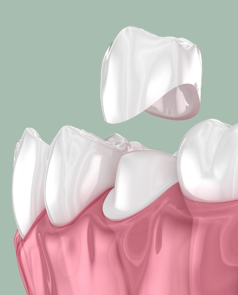 Treatments - Greenfield Dental Care