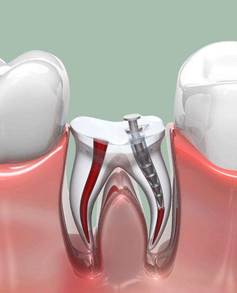 Treatments - Greenfield Dental Care