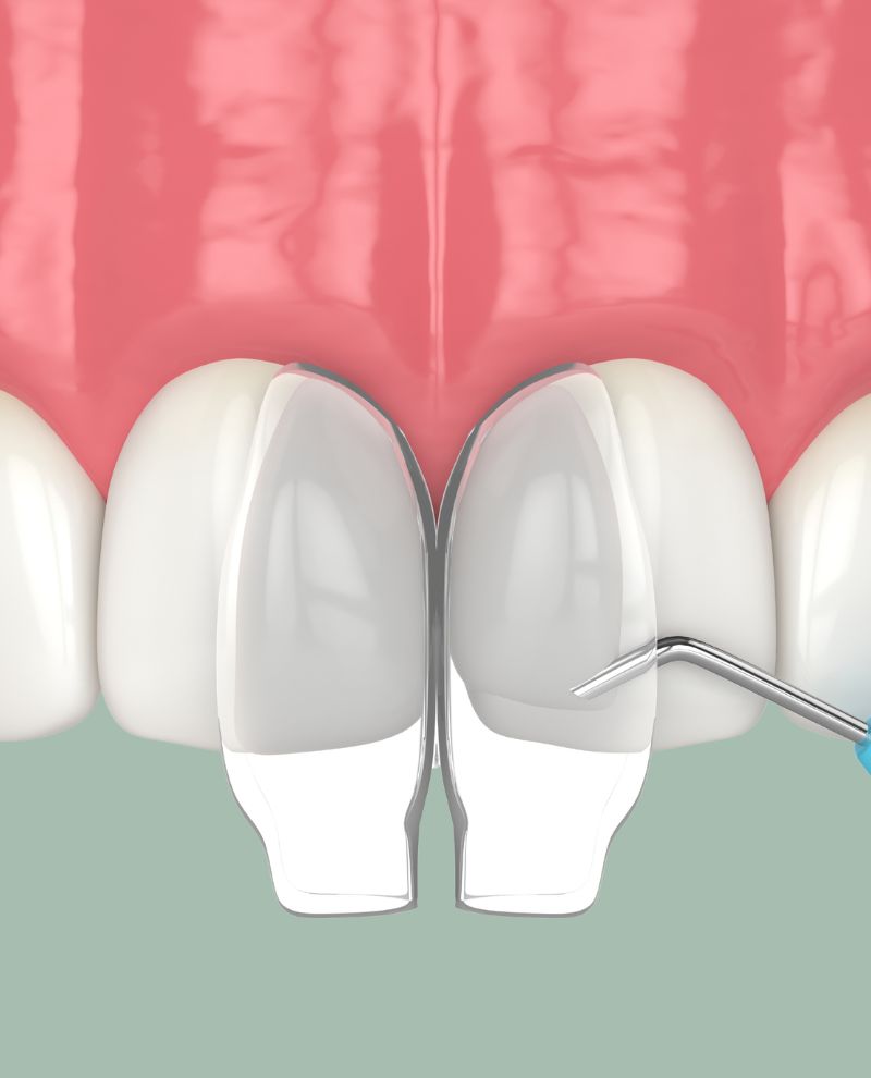 Treatments - Greenfield Dental Care